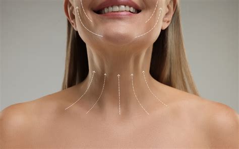 A diagram showing injection points for Botox on the neck to treat horizontal lines and platysmal bands.