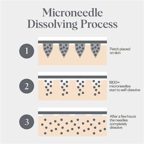 Infographic illustrating the process of microneedle patches delivering active ingredients into the skin.