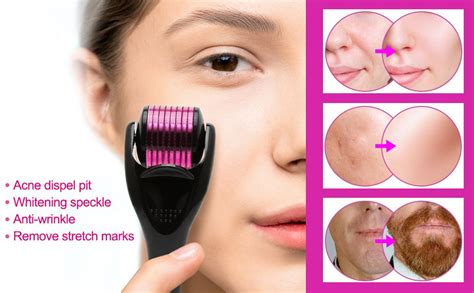 Image of an at-home microneedling device (derma-roller) with short needles.