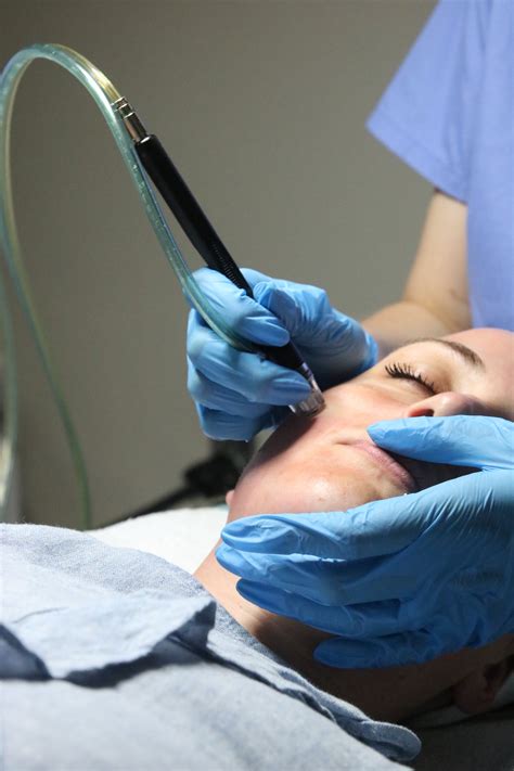 A dermatologist performing the Dermalinfusion procedure on a patient's face with a diamond-tipped wand.