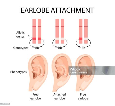 Diagram illustrating the anatomy of the earlobe and common types of damage like tears and stretching.