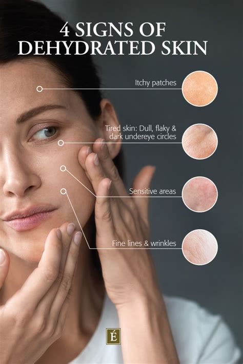 Infographic showing factors that contribute to oily skin, such as heat, humidity, dehydration, and harsh skincare products.