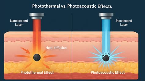 Infographic comparing photoacoustic (Pico Laser) and photothermal (traditional lasers) effects.
