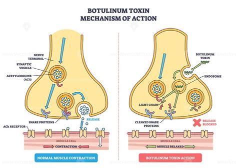 Diagram illustrating how botulinum toxin blocks nerve signals to muscles, leading to wrinkle reduction.