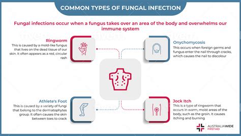 Infographic comparing different types of fungal infections in dogs and their common treatments.