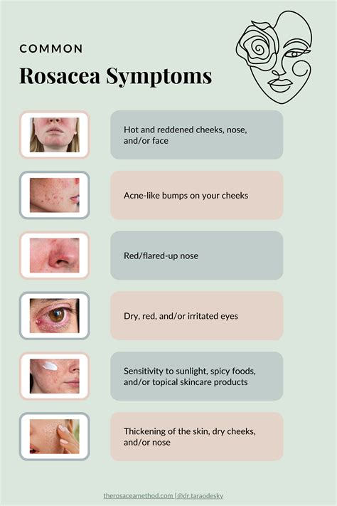 Infographic illustrating common rosacea triggers and symptoms.