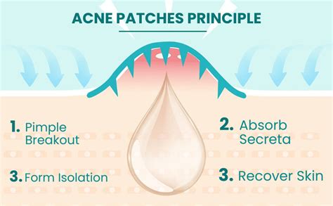 Infographic showing the absorption process of hydrocolloid pimple patches