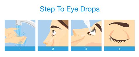 Infographic demonstrating the correct way to apply eye drops