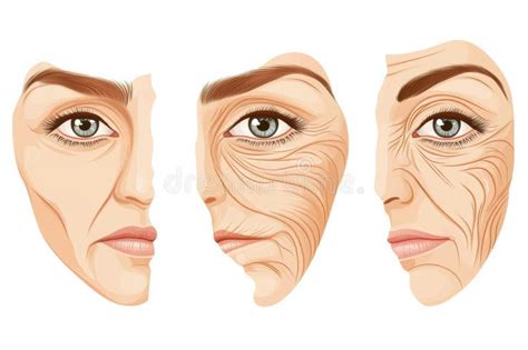 Aesthetic photo of a woman with smooth, natural-looking skin, subtly highlighting the effects of Botox.