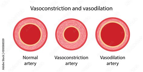 Diagram illustrating vasodilation and vasoconstriction of blood vessels in the skin