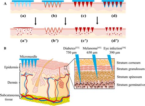 Diagram showing the structure and function of soluble microneedles.