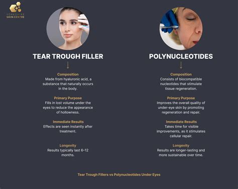 An infographic listing potential side effects and risks of tear trough fillers, with icons for each.