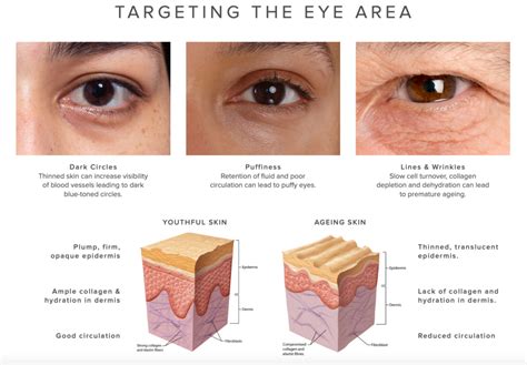 Illustration showing the delicate skin around the eye area and common concerns like dark circles and fine lines.