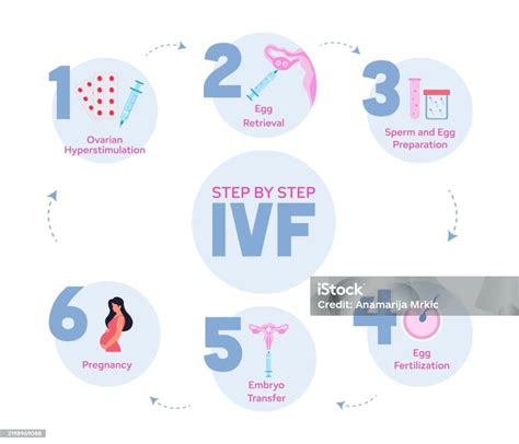 An infographic illustrating the key stages of the IVF process.