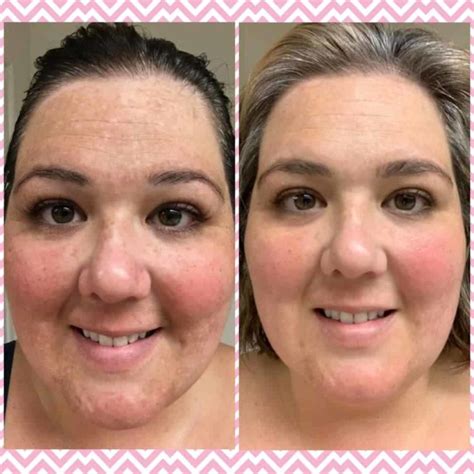 A visual representation of the skin before and after using the Charcoal Mask or Overnight Resurfacing Peel.