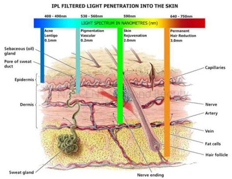 Diagram illustrating how IPL light penetrates the skin layers and targets pigment and blood vessels.