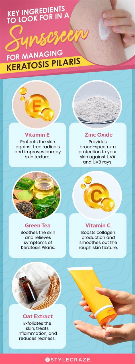 Infographic comparing different types of moisturizers and their key ingredients for managing keratosis pilaris.