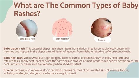 Infographic showing common baby rashes and spots, with a section highlighting petechiae and when to seek medical help