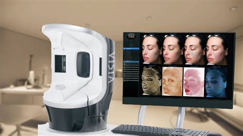 Dermatologist examining a patient's skin with a VISIA analysis machine