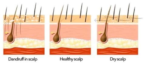 Collage of images showing healthy vs. unhealthy scalps.