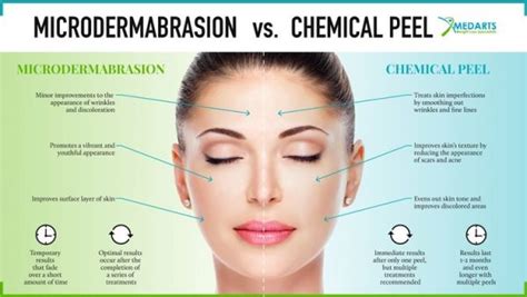 Infographic comparing chemical peels, microdermabrasion, and laser resurfacing.