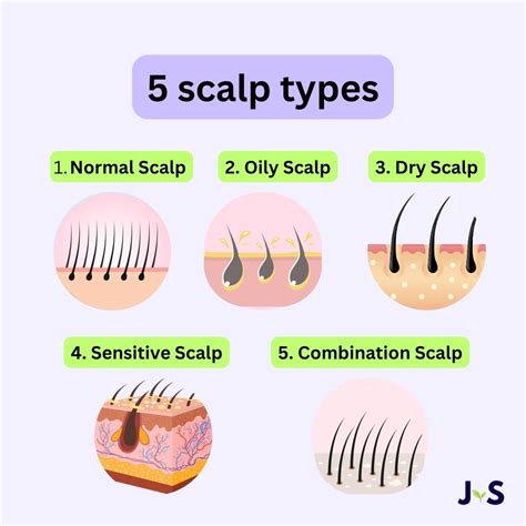 Infographic showing different scalp types and recommended oils.