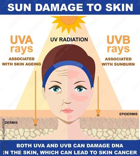 Infographic illustrating the cumulative nature of sun damage and skin cancer risk