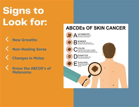 Infographic illustrating the stages of skin cancer and the importance of early detection.