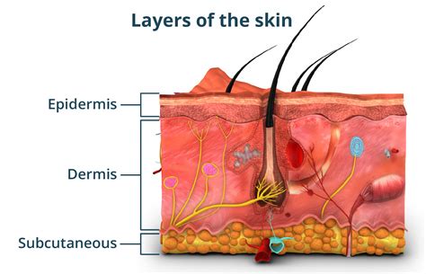 Diagram showing the layers of the skin and how different treatments target each layer.