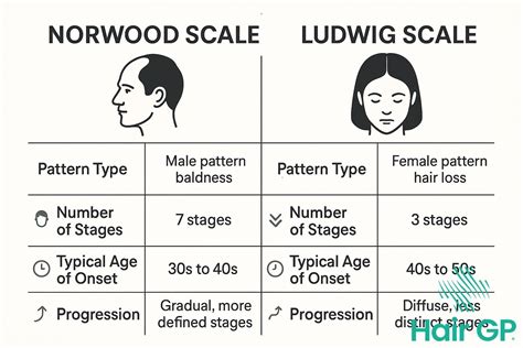 Diagram illustrating the different stages of hair loss according to the Norwood-Hamilton scale for men and the Ludwig scale for women.