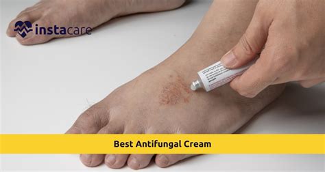 Diagram showing correct application of antifungal cream to a child's skin, emphasizing gentle application to affected areas.