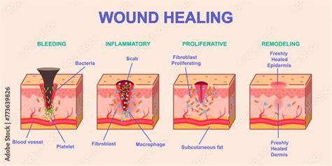Diagram illustrating the process of skin wound healing involving keratinocytes