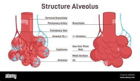 Diagram illustrating the difference between healthy alveoli and those affected by emphysema, showing destruction of alveolar walls and reduced surface area for gas exchange.