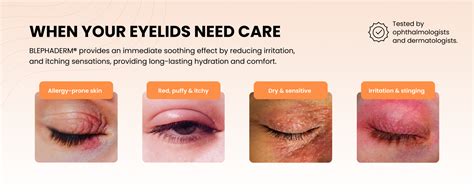 Infographic showing the benefits of Blephaderm for eye health