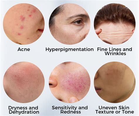 Collage of images showcasing different skin concerns like dryness, redness, and dark spots.
