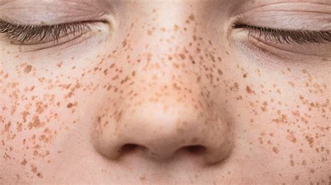 A visual demonstration of dotting small clusters of faux freckles on the nose and cheeks.