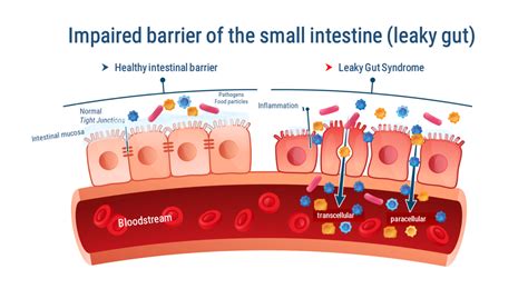 illustration of a healthy gut barrier versus a compromised 