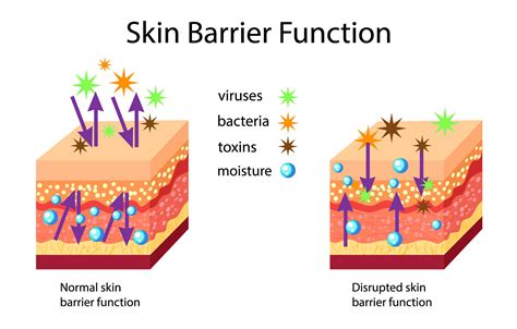 Diagram illustrating the function of the skin barrier in protecting against external aggressors