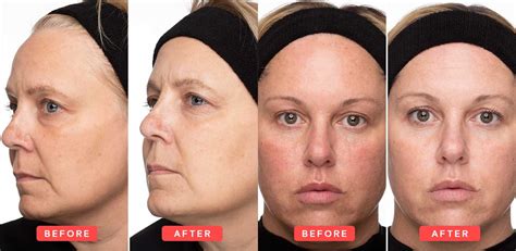 Collage of user-generated photos showing before and after results from using Nu Skin products.