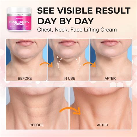 Before and after images demonstrating the Uplift Firming Serum's effect on the neck and jawline