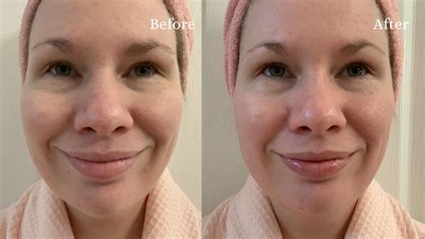 Before and after images showing the InvisiCrepe Body Balm's effect on crepey skin on the chest