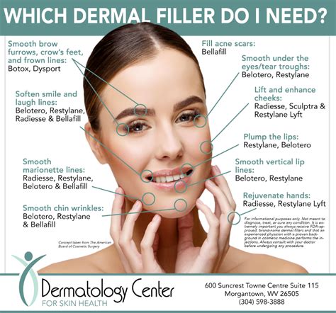 Infographic comparing different types of dermal fillers and their applications.
