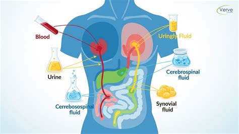 Illustration showing various body fluids that can transmit Ebola.
