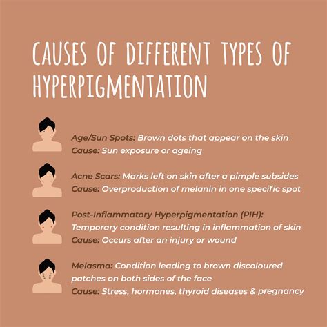 Infographic illustrating different types of hyperpigmentation and their causes.