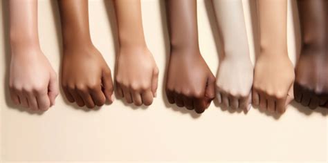 A visual comparison of different skin tones and their susceptibility to hyperpigmentation.