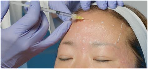 A group of medical professionals participating in a hands-on botox training session, with an instructor guiding them.
