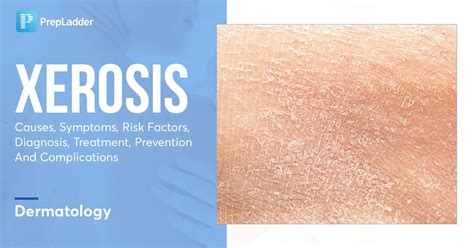 Infographic explaining the causes and symptoms of xerosis (very dry skin)