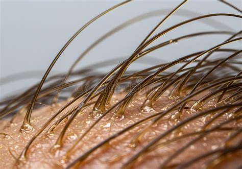 Close-up of a scalp analysis using a high-tech camera, highlighting individual hair follicles and scalp condition.