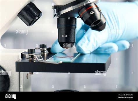 A close-up of a dermatopathologist examining a biopsy slide under a microscope.