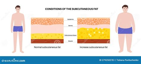 Infographic comparing the appearance and feel of loose skin versus residual subcutaneous fat.